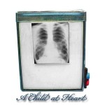 (*) Dollhouse Miniature X-Ray Screen Box